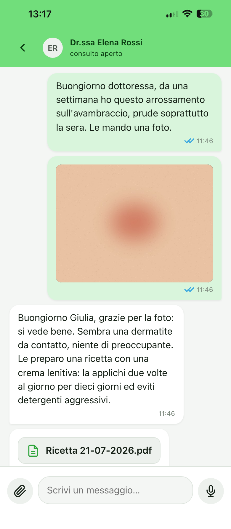 La chat del consulto